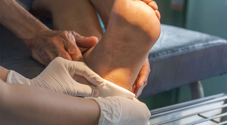 Medical professional applying care to a patient's foot, emphasizing diabetic foot treatment and wound management.