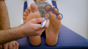 Healthcare professional performing a nerve sensation test on a patient’s foot using a monofilament tool.