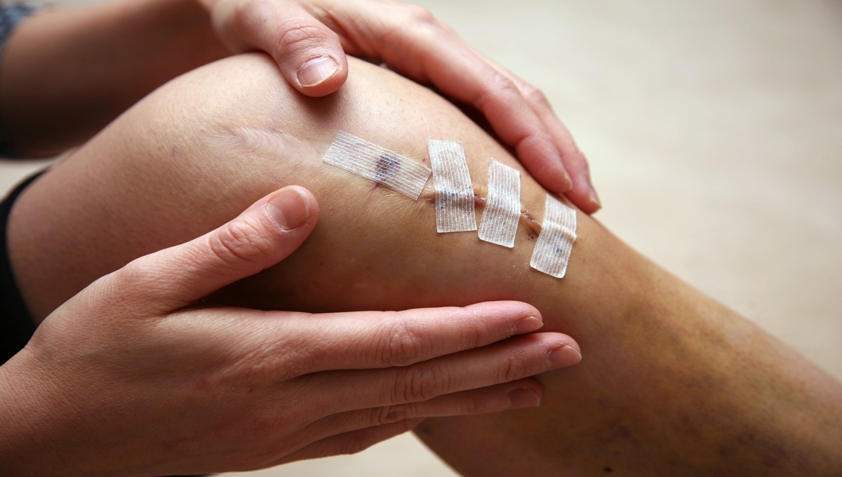 Healing knee wound with surgical strips after invasive procedure