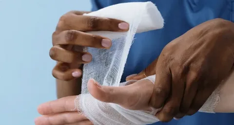 Medical professional bandaging a hand during wound care treatment